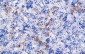 Thyroid Stimulating Hormone Antibody